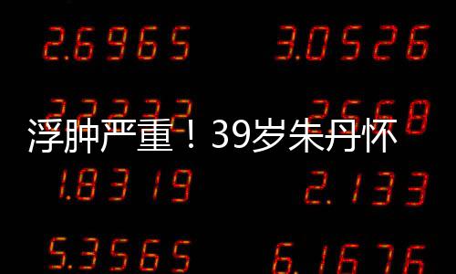 带货7个朱丹直播怀孕坚持严重月 9岁深夜浮肿